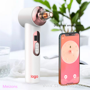 Facial Visual Phone Linked Display Wifi Blackhead Remover